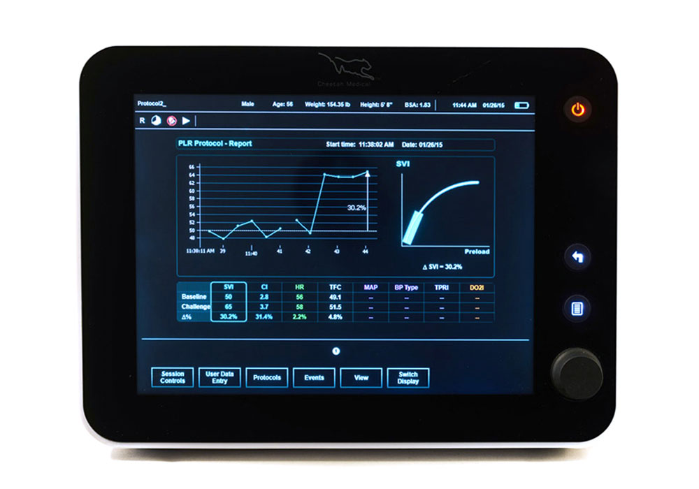 Starling SV Noninvasive Hemodynamic Monitoring System – AA Medical